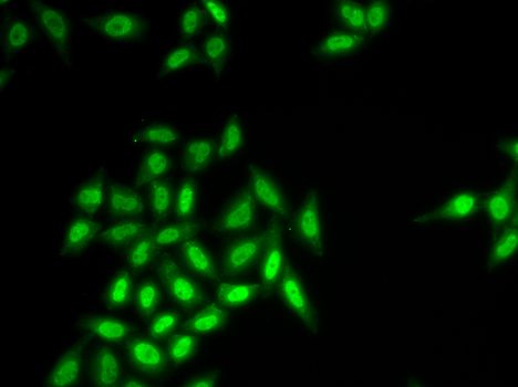 Immunofluorescence analysis of HeLa cells using SETMAR Polyclonal Antibody