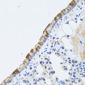 Immunohistochemistry of paraffin-embedded Rat lung using ST3GAL3 Polyclonal Antibody at dilution of  1:100 (40x lens).