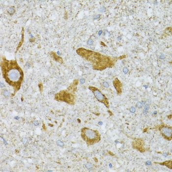 Immunohistochemistry of paraffin-embedded Mouse spinal cord using ST3GAL3 Polyclonal Antibody at dilution of  1:100 (40x lens).