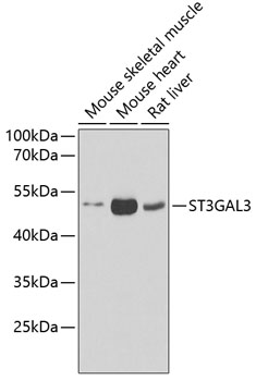 Western blot analysis of extracts of various cell lines using ST3GAL3 Polyclonal Antibody at dilution of 1:1000.