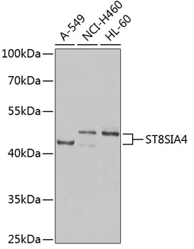 Western blot analysis of extracts of various cell lines using ST8SIA4 Polyclonal Antibody at dilution of 1:1000.