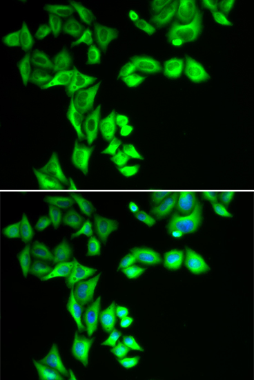 Immunofluorescence analysis of HeLa cells using STRN3 Polyclonal Antibody