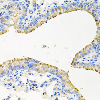 Immunohistochemistry of paraffin-embedded Mouse lung using STRN3 Polyclonal Antibody at dilution of  1:100 (40x lens).