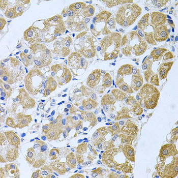 Immunohistochemistry of paraffin-embedded Human stomach using STRN3 Polyclonal Antibody at dilution of  1:100 (40x lens).