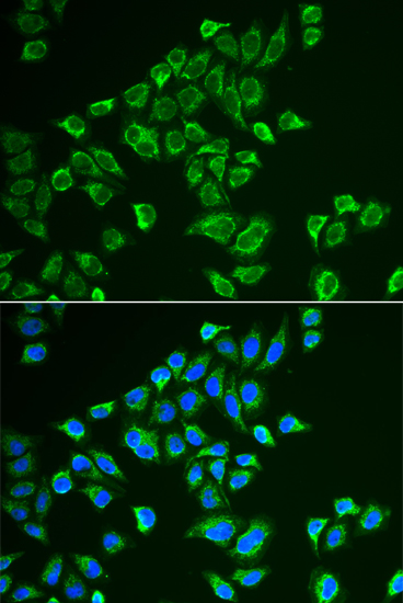 Immunofluorescence analysis of HeLa cells using TAGLN Polyclonal Antibody