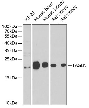 Western blot analysis of extracts of various cell lines using TAGLN Polyclonal Antibody at dilution of 1:1000.