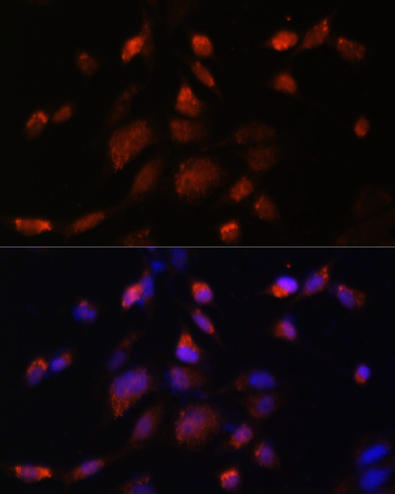 Immunofluorescence analysis of NIH-3T3 cells using TMED10 Polyclonal Antibody at dilution of  1:100. Blue: DAPI for nuclear staining.