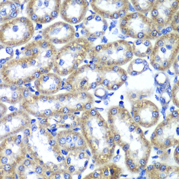Immunohistochemistry of paraffin-embedded Rat kidney using TMED10 Polyclonal Antibody at dilution of  1:100 (40x lens).