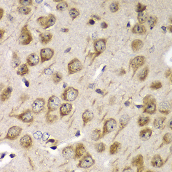 Immunohistochemistry of paraffin-embedded Mouse brain using TMED10 Polyclonal Antibody at dilution of  1:100 (40x lens).