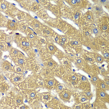 Immunohistochemistry of paraffin-embedded Human liver damage using TMED10 Polyclonal Antibody at dilution of  1:100 (40x lens).
