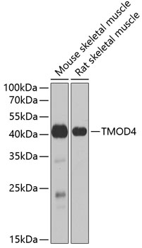 Western blot analysis of extracts of various cell lines using TMOD4 Polyclonal Antibody at dilution of 1:1000.