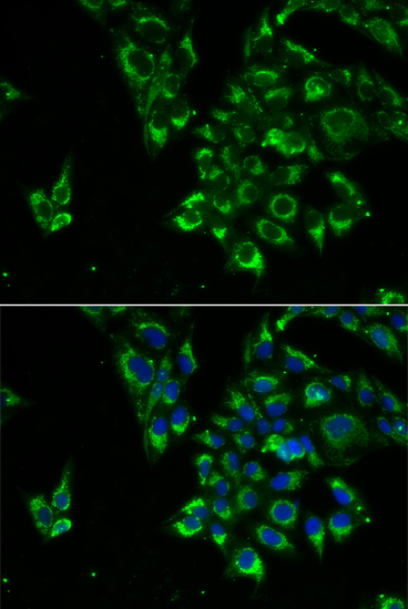 Immunofluorescence analysis of U2OS cells using TSHB Polyclonal Antibody