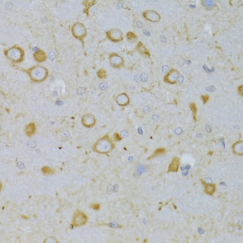 Immunohistochemistry of paraffin-embedded Rat brain using TSHR Polyclonal Antibody at dilution of  1:100 (40x lens).