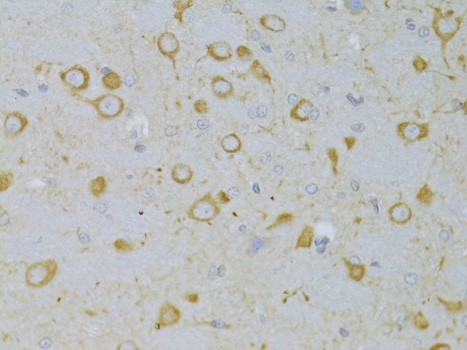 Immunohistochemistry of paraffin-embedded Rat brain using TSHR Polyclonal Antibody at dilution of  1:100 (40x lens).