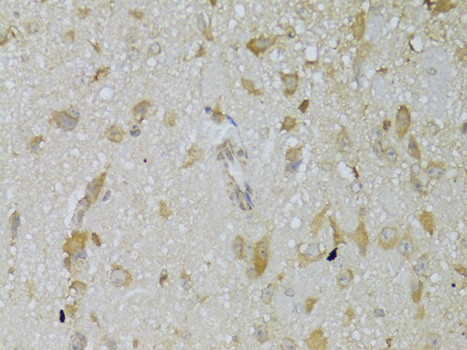 Immunohistochemistry of paraffin-embedded Mouse brain using TSHR Polyclonal Antibody at dilution of  1:100 (40x lens).
