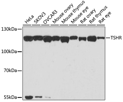 Western blot analysis of extracts of various cell lines using TSHR Polyclonal Antibody at dilution of 1:1000.