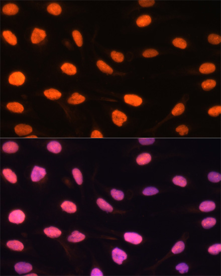 Immunofluorescence analysis of U-2 OS cells using ZBED1 Polyclonal Antibody at dilution of  1:100. Blue: DAPI for nuclear staining.