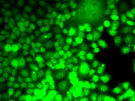 Immunofluorescence analysis of MCF7 cells using ALOX15B Polyclonal Antibody