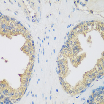 Immunohistochemistry of paraffin-embedded Human prostate using ENPEP Polyclonal Antibody at dilution of  1:200 (40x lens).