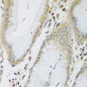 Immunohistochemistry of paraffin-embedded Human stomach using ENPEP Polyclonal Antibody at dilution of  1:200 (40x lens).