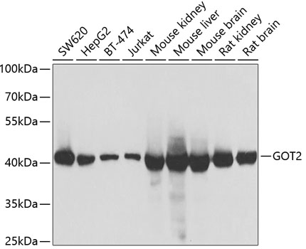 Western blot analysis of extracts of various cell lines using GOT2 Polyclonal Antibody at dilution of 1:1000.