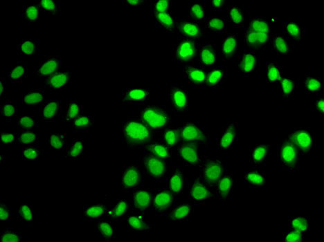 Immunofluorescence analysis of MCF7 cells using GPS1 Polyclonal Antibody