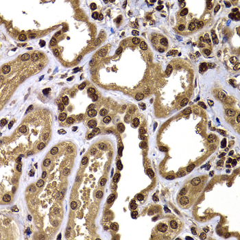 Immunohistochemistry of paraffin-embedded Human kidney using GPS1 Polyclonal Antibody at dilution of  1:100 (40x lens).