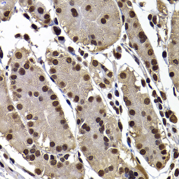 Immunohistochemistry of paraffin-embedded Human stomach using GPS1 Polyclonal Antibody at dilution of  1:100 (40x lens).