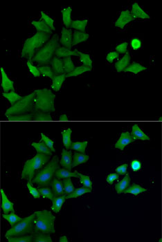 Immunofluorescence analysis of MCF7 cells using HABP2 Polyclonal Antibody