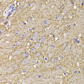 Immunohistochemistry of paraffin-embedded Mouse brain using KCND3 Polyclonal Antibody at dilution of  1:100 (40x lens).