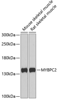 Western blot analysis of extracts of various cell lines using MYBPC2 Polyclonal Antibody at dilution of 1:1000.