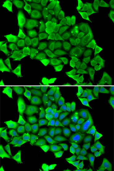 Immunofluorescence analysis of U2OS cells using MYH1 Polyclonal Antibody