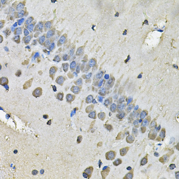 Immunohistochemistry of paraffin-embedded Rat brain using MYH1 Polyclonal Antibody at dilution of  1:100 (40x lens).