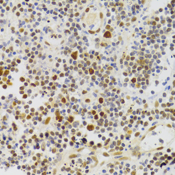 Immunohistochemistry of paraffin-embedded Human appendicitis using NASP Polyclonal Antibody at dilution of  1:100 (40x lens).
