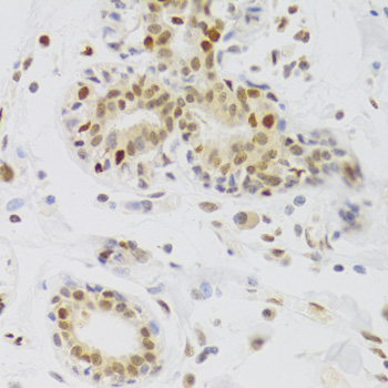Immunohistochemistry of paraffin-embedded Human breast using NASP Polyclonal Antibody at dilution of  1:100 (40x lens).