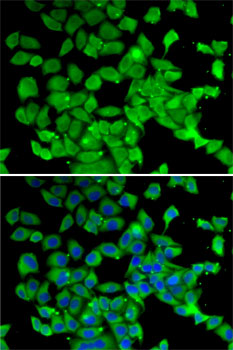 Immunofluorescence analysis of MCF7 cells using PARN Polyclonal Antibody