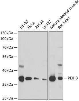 Western blot analysis of extracts of various cell lines using PDHB Polyclonal Antibody at dilution of 1:1000.