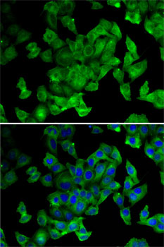 Immunofluorescence analysis of MCF7 cells using PPL Polyclonal Antibody