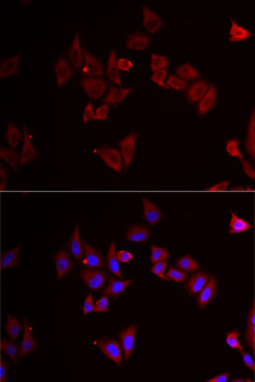 Immunofluorescence analysis of MCF7 cells using MAP2K5 Polyclonal Antibody