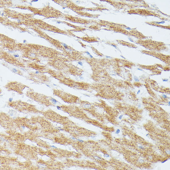 Immunohistochemistry of paraffin-embedded Rat heart using MAP2K5 Polyclonal Antibody at dilution of  1:100 (40x lens).