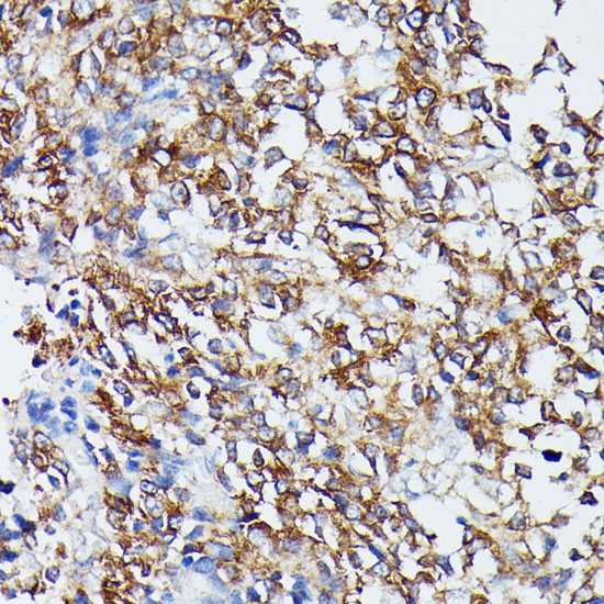 Immunohistochemistry of paraffin-embedded Human appendix using MAP2K5 Polyclonal Antibody at dilution of  1:100 (40x lens).