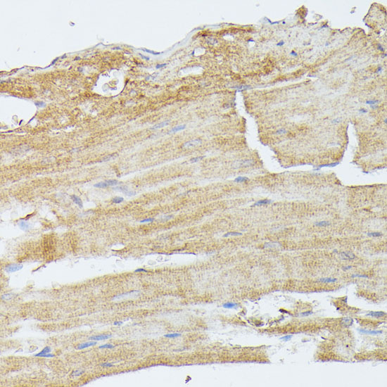 Immunohistochemistry of paraffin-embedded Mouse heart using MAP2K5 Polyclonal Antibody at dilution of  1:100 (40x lens).