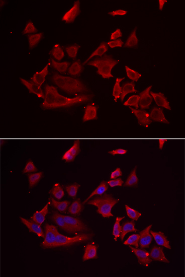 Immunofluorescence analysis of MCF-7 cells using RARRES2 Polyclonal Antibody