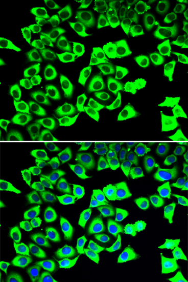 Immunofluorescence analysis of U2OS cells using RPLP2 Polyclonal Antibody