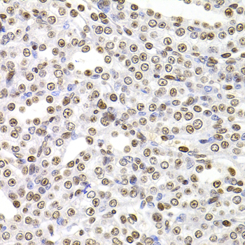 Immunohistochemistry of paraffin-embedded Rat kidney using SOX5 Polyclonal Antibody at dilution of  1:100 (40x lens).