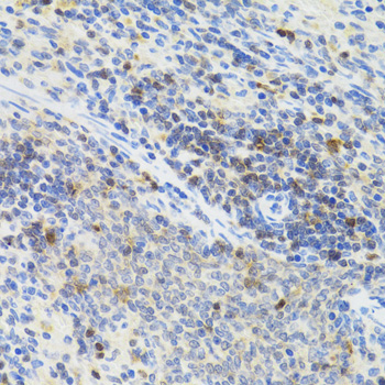 Immunohistochemistry of paraffin-embedded Rat spleen using STAT4 Polyclonal Antibody at dilution of  1:100 (40x lens).