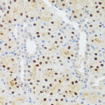 Immunohistochemistry of paraffin-embedded Rat kidney using STAT4 Polyclonal Antibody at dilution of  1:100 (40x lens).