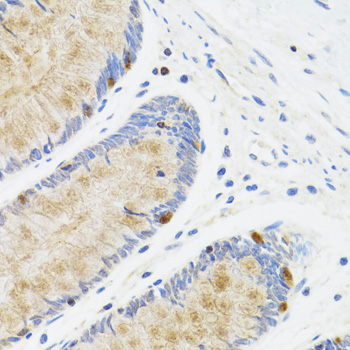 Immunohistochemistry of paraffin-embedded Human rectum using STAT4 Polyclonal Antibody at dilution of  1:100 (40x lens).