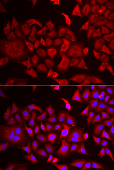 Immunofluorescence analysis of HeLa cells using TARS Polyclonal Antibody