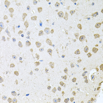 Immunohistochemistry of paraffin-embedded Mouse brain using TARS Polyclonal Antibody at dilution of  1:100 (40x lens).